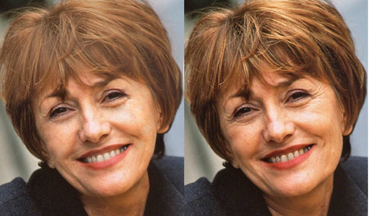 fotografija lica prije i poslije konturiranja